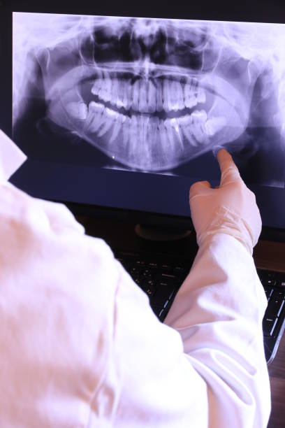 Best Emergency Denture Repair in Purdy, MO