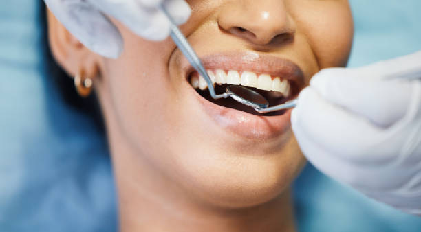 Best Broken or Chipped Tooth Repair in Purdy, MO